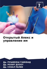 Produktbild: Otkrytyj Apex i uprawlenie im