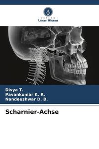 Produktbild: Scharnier-Achse