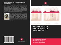 Produktbild: Protocolo De Coloca&ccedil;&atilde;o De Implantes