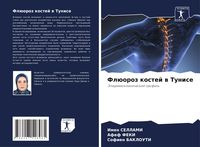 Produktbild: Fl&uuml;oroz kostej w Tunise