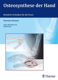 Produktbild: Osteosynthese der Hand
