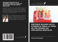 Produktbild: Enfoque Basado En La Evidencia Para La Toma De Decisiones En Implantes Dentales