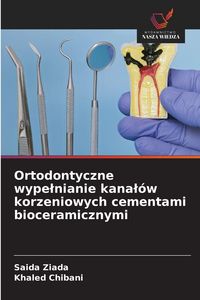 Produktbild: Ortodontyczne wype&iquest;nianie kana&iquest;&oacute;w korzeniowych cementami bioceramicznymi