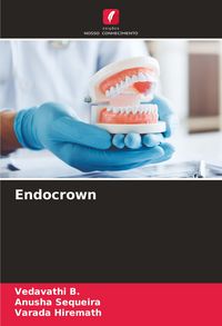 Produktbild: Endocrown