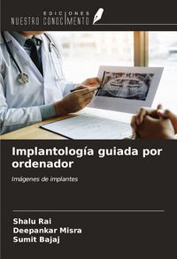 Produktbild: Implantolog&iacute;a guiada por ordenador