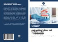 Produktbild: Abdrucktechniken bei festsitzenden Teilprothesen