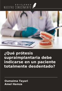 Produktbild: &iquest;Qu&eacute; pr&oacute;tesis supraimplantaria debe indicarse en un paciente totalmente desdentado?