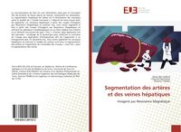 Produktbild: Segmentation des art&egrave;res et des veines h&eacute;patiques