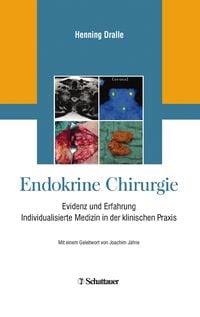 Produktbild: Endokrine Chirurgie