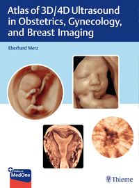 Produktbild: Atlas of 3D/4D Ultrasound in Obstetrics, Gynecology, and Breast Imaging