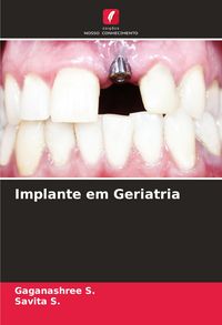 Produktbild: Implante em Geriatria