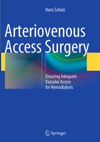 Produktbild: Arteriovenous Access Surgery