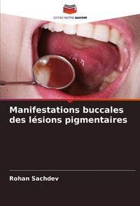 Produktbild: Manifestations buccales des l&eacute;sions pigmentaires