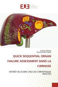 Produktbild: Quick Sequential Organ Failure Assessment Dans La Cirrhose
