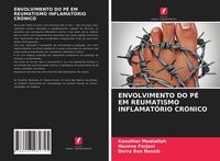 Produktbild: ENVOLVIMENTO DO P&Eacute; EM REUMATISMO INFLAMAT&Oacute;RIO CR&Oacute;NICO