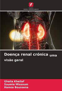 Produktbild: Doen&ccedil;a renal cr&oacute;nica uma vis&atilde;o geral