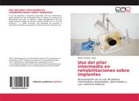 Produktbild: Uso del pilar intermedio en rehabilitaciones sobre implantes