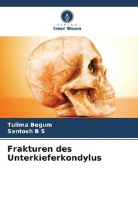 Produktbild: Frakturen des Unterkieferkondylus