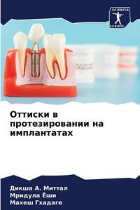 Produktbild: Ottiski w protezirowanii na implantatah