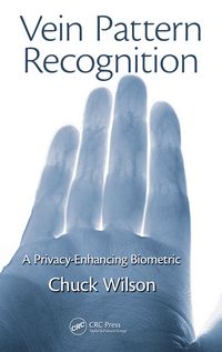 Produktbild: Vein Pattern Recognition