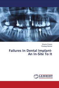 Produktbild: Failures In Dental Implant- An In-Site To It