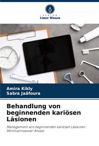 Produktbild: Behandlung von beginnenden kari&ouml;sen L&auml;sionen