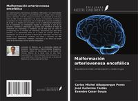 Produktbild: Malformaci&oacute;n arteriovenosa encef&aacute;lica