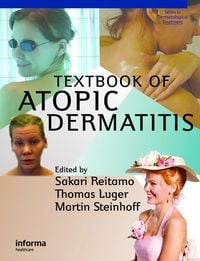 Produktbild: Textbook of Atopic Dermatitis