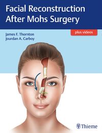 Produktbild: Facial Reconstruction After Mohs Surgery