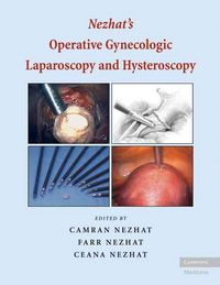 Produktbild: Nezhats Operative Gynecologic