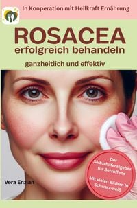 Produktbild: Rosacea erfolgreich behandeln - ganzheitlich und effektiv: Der Selbsthilferatgeber f&uuml;r Betroffene mit Tipps, die wirklich funktionieren