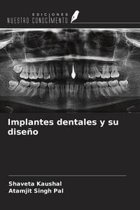 Produktbild: Implantes dentales y su dise&ntilde;o