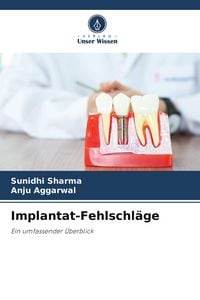 Produktbild: Implantat-Fehlschl&auml;ge