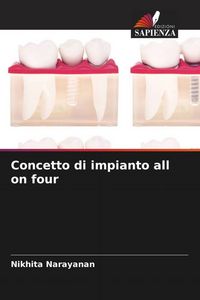 Produktbild: Concetto di impianto all on four