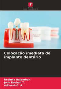 Produktbild: Coloca&ccedil;&atilde;o imediata de implante dent&aacute;rio