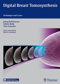 Produktbild: Digital Breast Tomosynthesis