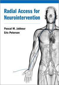 Produktbild: Radial Access for Neurointervention