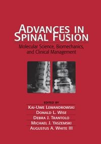 Produktbild: Advances in Spinal Fusion