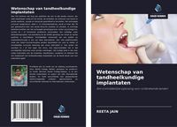 Produktbild: Wetenschap van tandheelkundige implantaten