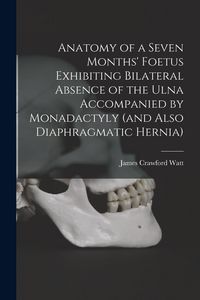 Produktbild: Anatomy of a Seven Months' Foetus Exhibiting Bilateral Absence of the Ulna Accompanied by Monadactyly (and Also Diaphragmatic Hernia) [microform]