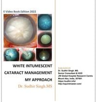 Produktbild: White Intumescent Cataract Management: My Approach (2022, #1)