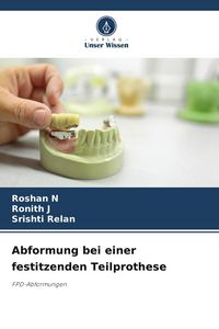 Produktbild: Abformung bei einer festitzenden Teilprothese