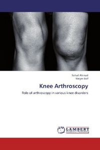 Produktbild: Ahmad, S: Knee Arthroscopy