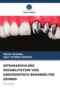 Produktbild: Intraradikul&auml;re Rehabilitation von Endodontisch Behandelten Z&auml;hnen