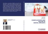 Produktbild: Complications and Failure in Dental Implants