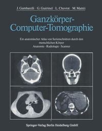 Produktbild: Ganzk&ouml;rper-Computer-Tomographie