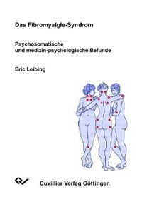 Produktbild: Leibing, E: Fibromyalgie-Syndrom