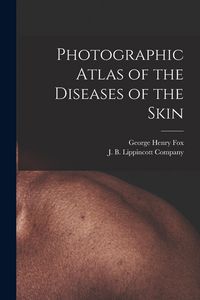 Produktbild: Photographic Atlas of the Diseases of the Skin