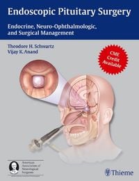 Produktbild: Endoscopic Pituitary Surgery