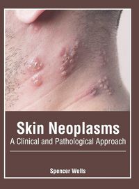 Produktbild: Skin Neoplasms: A Clinical and Pathological Approach